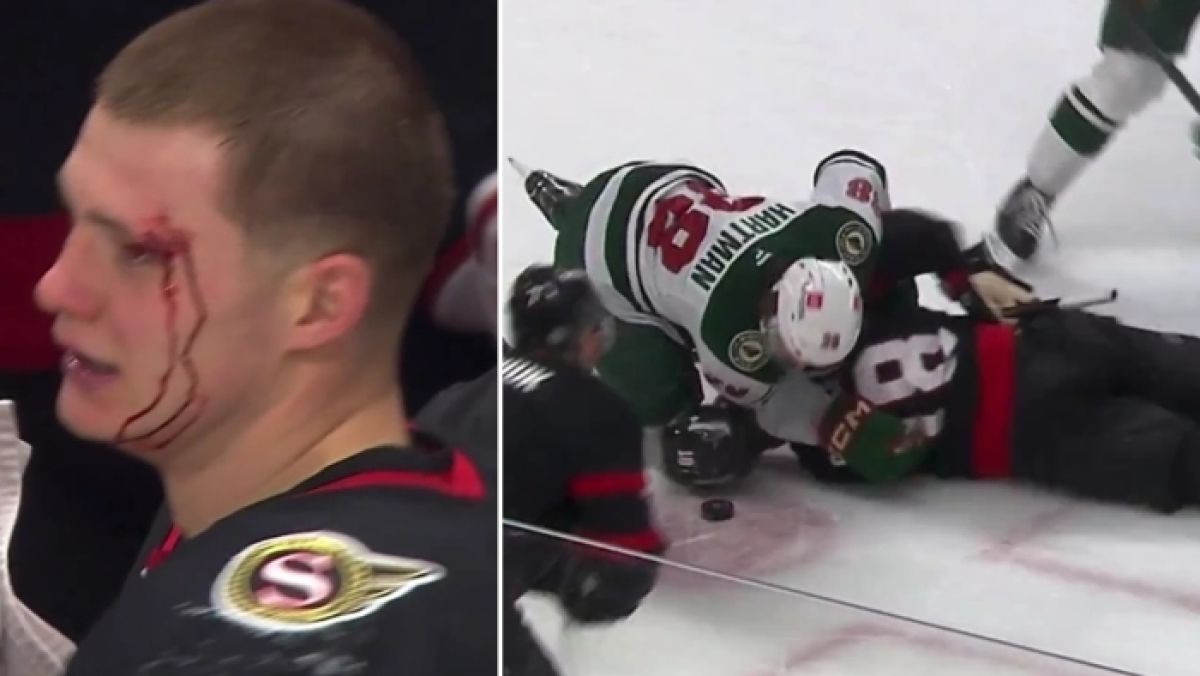 Gracz Minnesota Wild Ryan Hartman otrzymał karę meczu za próbę doprowadzenia do kontuzji Tima Stützle (z lewej) podczas spotkania z Ottawa Senators w NHL.
